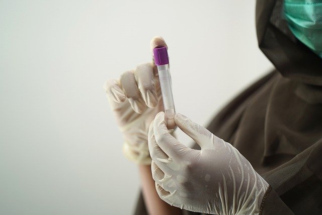 Blood Test Blood Sample  - shameersrk / Pixabay